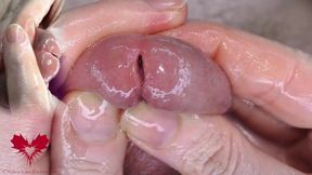 Super close-up of the glans. Urethral games with the dilator.